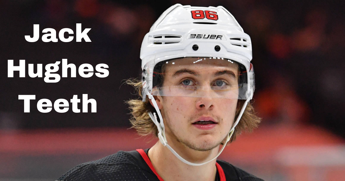 Jack Hughes Teeth