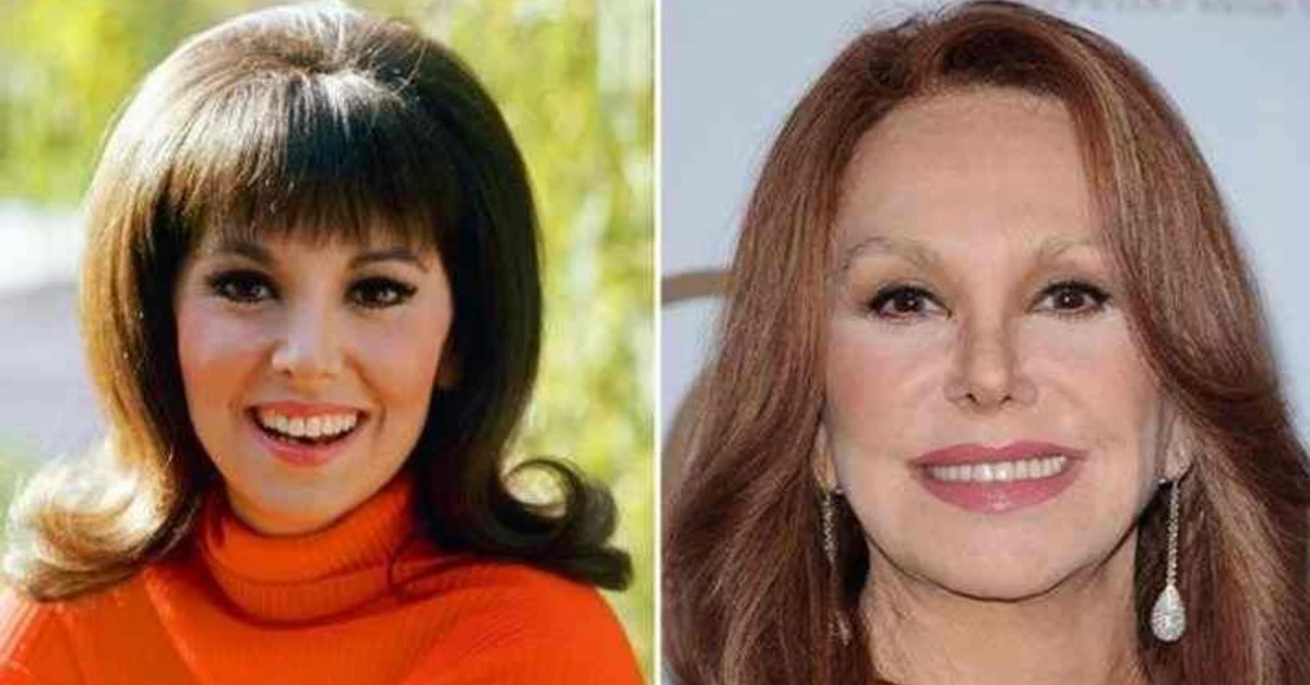 Marlo Thomas Plastic Surgery